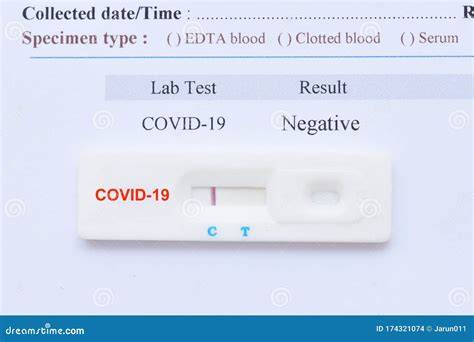 Negative HBsAg test result