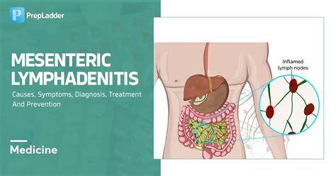 non specific mesenteric lymphadenitis meaning in english