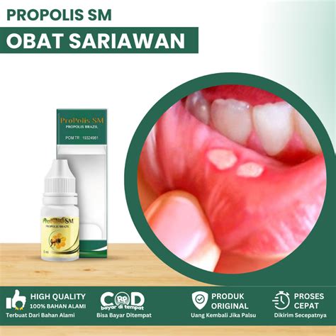 obat sariawan