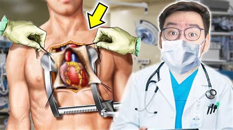 Operasi Jantung
