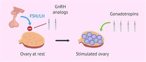 Ovarian Stimulation IVF
