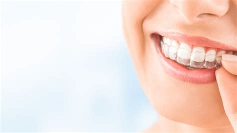 Payment Options for Invisalign Treatment