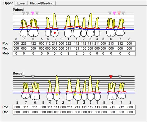 perio charting examples