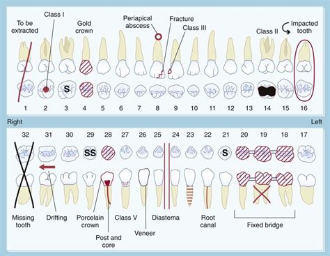 periodontal exam code
