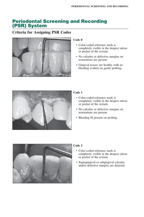 periodontal probing code