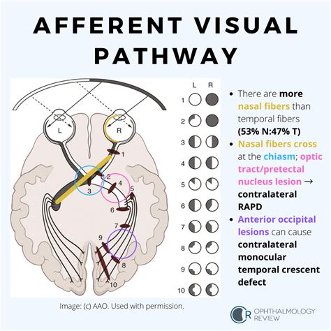 process of visual pathway