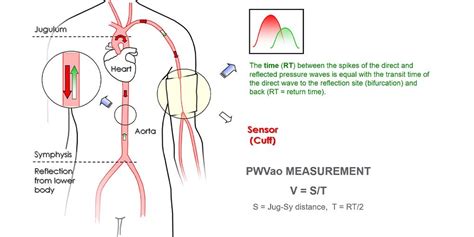 pulse wave velocity meaning