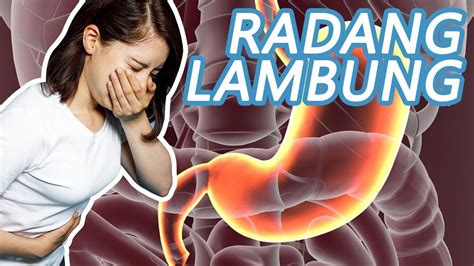 radang lambung