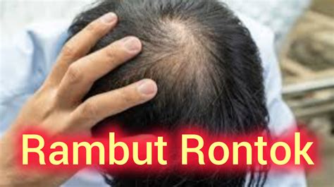 rambut rontok