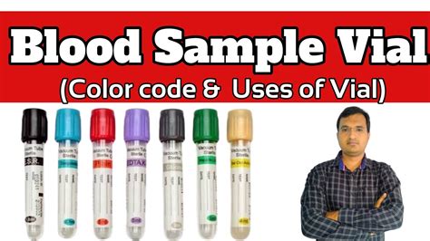 sample bottle colour code