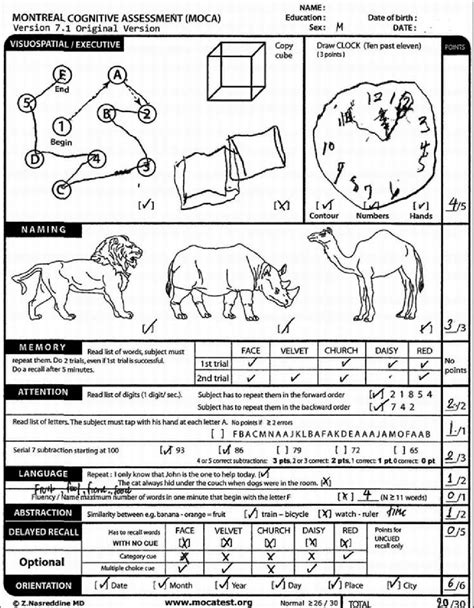 senior cognitive test example