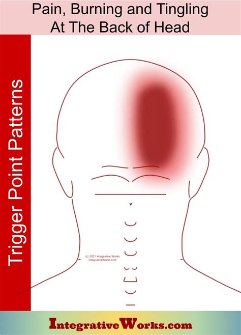 sharp pain in back of head on right side