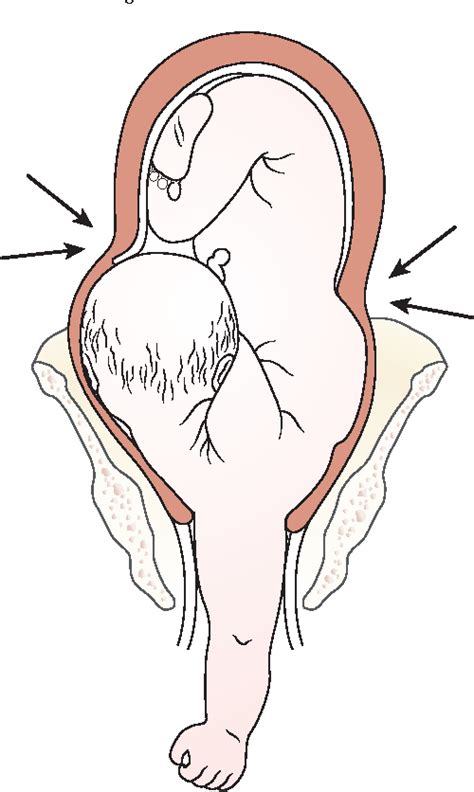 shoulder presentation definition in obg