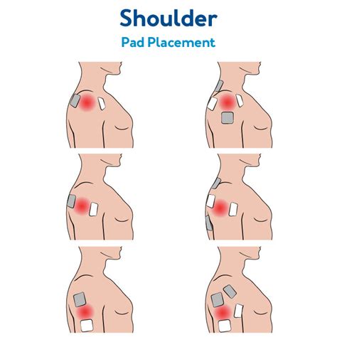 Shoulder Tens Placement Chart