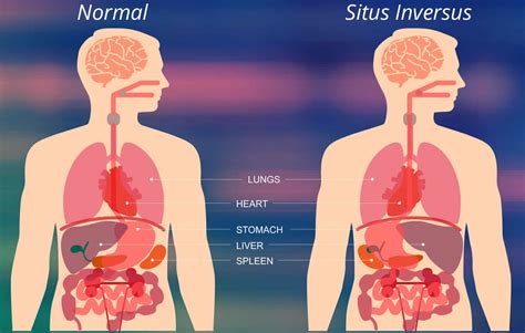 Situs Inversus Walkthrough