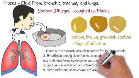 Sputum test for TB