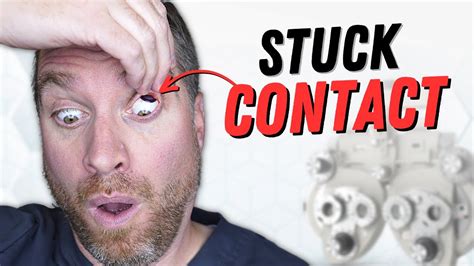 stuck in upper eyelid