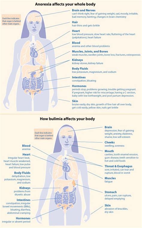 symptoms of anorexia vs bulimia
