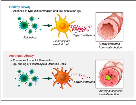 type 1 vs type 2 inflammation
