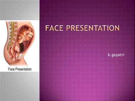 types of face presentation slideshare