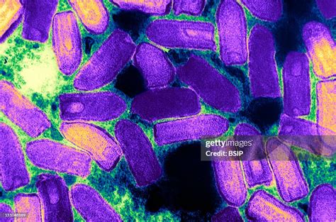 vesicular stomatitis virus