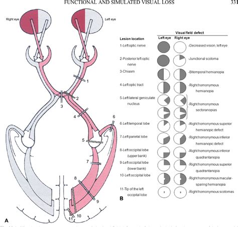 visual field pathway explained