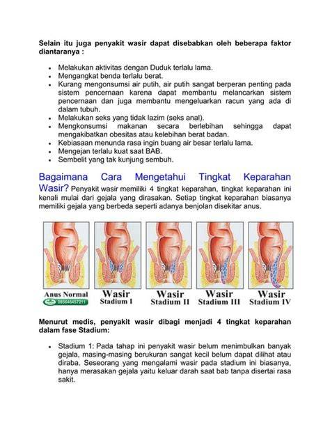 wasir