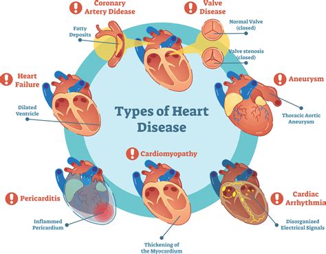 what are examples of heart problems