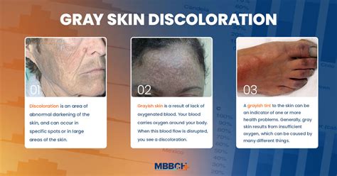 what causes grey complexion