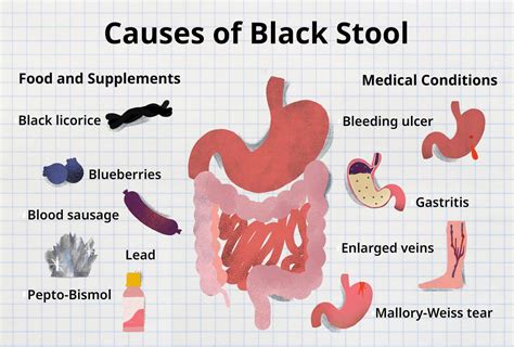what causes your stool to be black in color