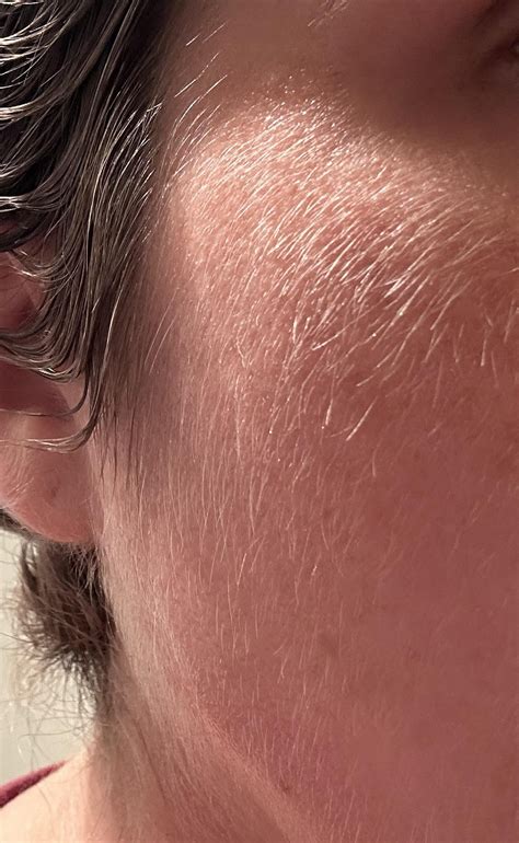 what color is peach fuzz on face