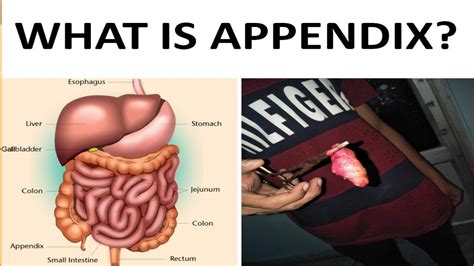what do we need the appendix for