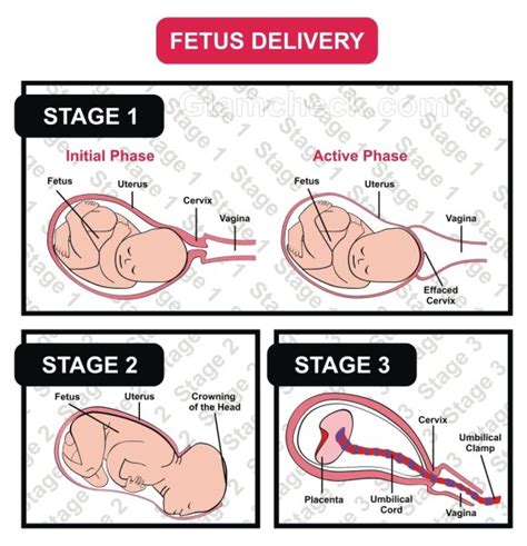 what does code green mean in labor and delivery