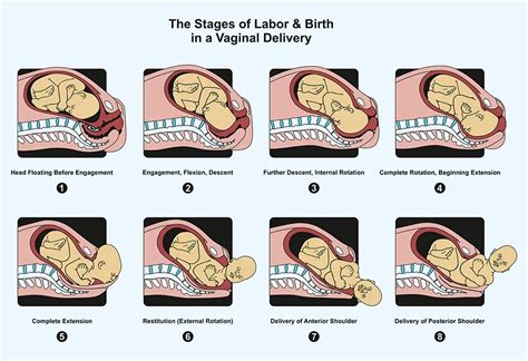 what does code white mean in labor and delivery