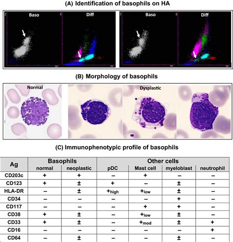 what is abs basophils in cbc