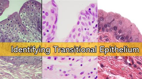 what is another name for transitional epithelium