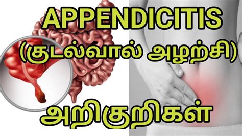 what is called appendix in tamil