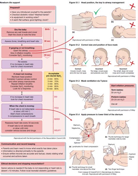 what is dart in neonates
