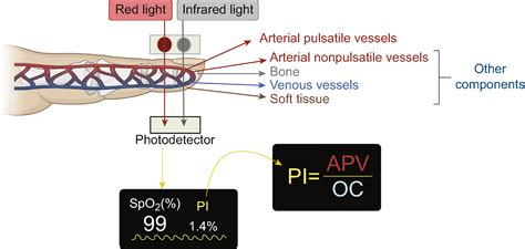 what is decreased peripheral perfusion