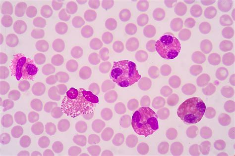 what is eosinophil in lab work