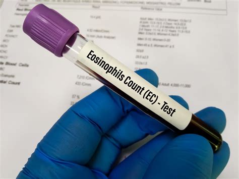what is eosinophils absolute in a blood test