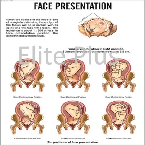 what is face presentation in pregnancy