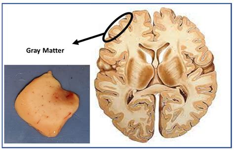 what is grey matter in the brain