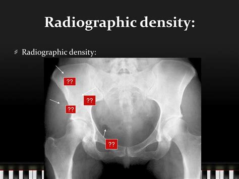 what is image density in radiography