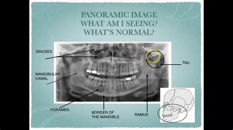 what is image interpretation in radiography