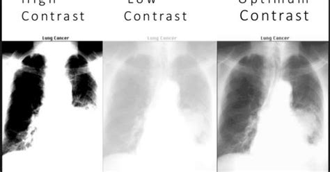 what is image quality in radiography