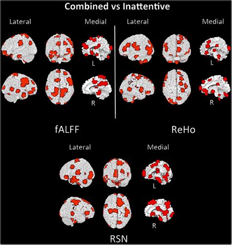 what is pattern recognition in adhd