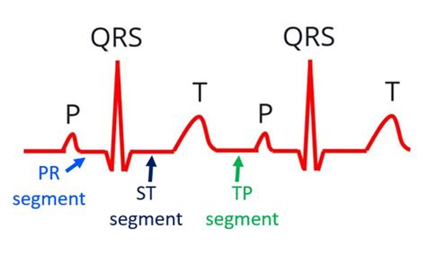 what is represented by the st segment in an ecg