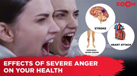 what is severe anger called
