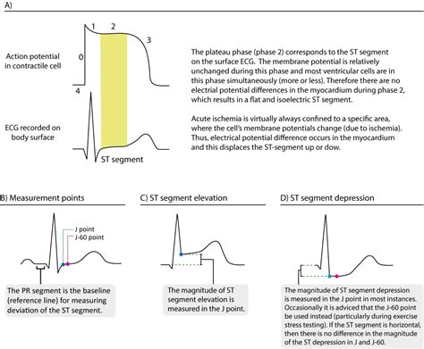 what is st-t changes in ecg